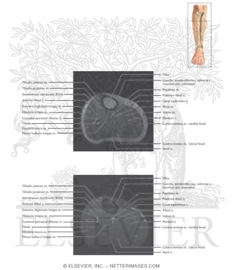 Watermarked preview of labeled image: Cross Section of the Lower Leg: Axial View