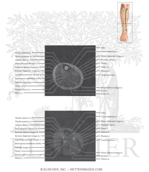 Watermarked preview of labeled image: Cross Section of the Lower Leg: Axial View