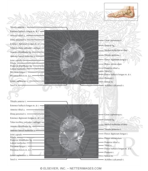 Watermarked preview of labeled image: Cross Section of the Ankle and Foot: Axial View