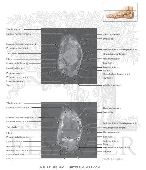 Watermarked preview of labeled image: Cross Section of the Ankle and Foot: Axial View