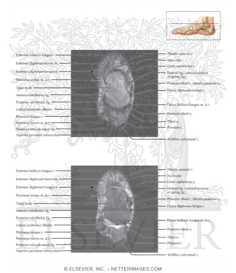 Watermarked preview of labeled image: Cross Section of the Ankle and Foot: Axial View