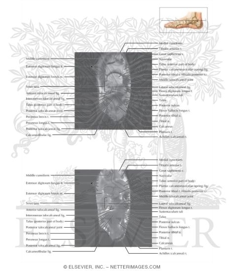 Watermarked preview of labeled image: Cross Section of the Ankle and Foot: Axial View