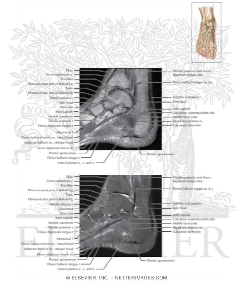 Cross Section of the Ankle and Foot: Coronal View