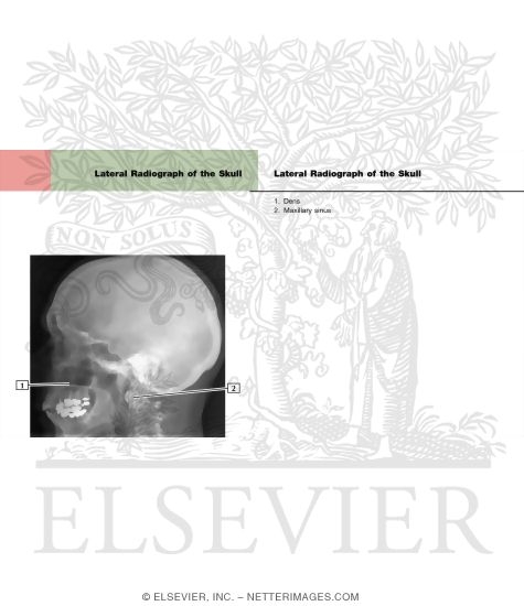 Skull: Lateral Radiograph