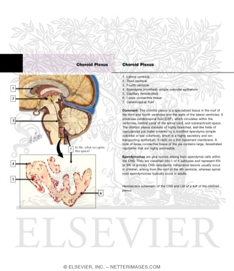 Watermarked preview of labeled image: Circulation of Cerebrospinal Fluid