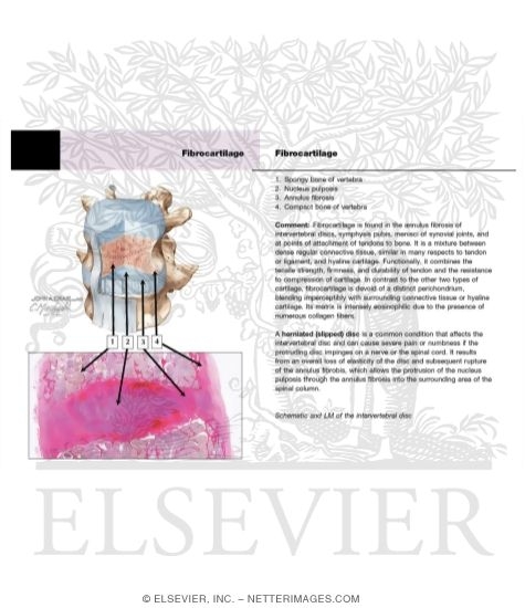 An Intervertebral Disc Connects Bodies of Adjacent Vertebrae With Low-magnification Light Micrograph of an Intervertebral Disc In Longitudinal Section AndLight Micrograph of
fibrocartilage of the Annulus Fibrosis of an Intervertebral Disc