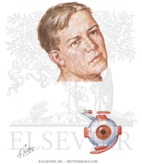 Watermarked preview of unlabeled image: Trochlear Nerve (CN-IV)