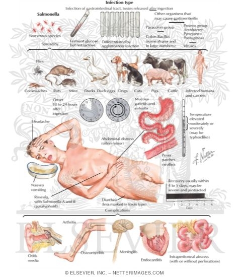 Watermarked preview of labeled image: Infection Type of Food Poisoning 