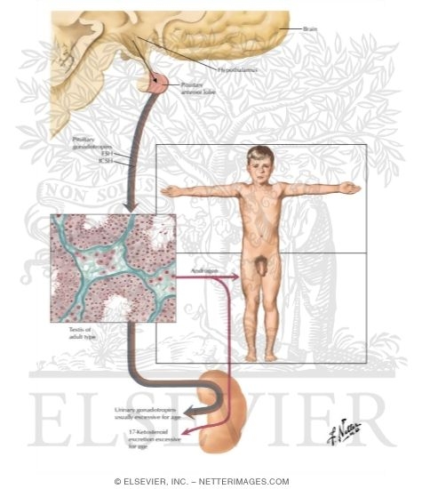 Sexual Precocity I - Celebral Type