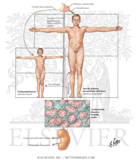 Testicular Failure II - Secondary or Hypogonadotropic Hypogonadism
