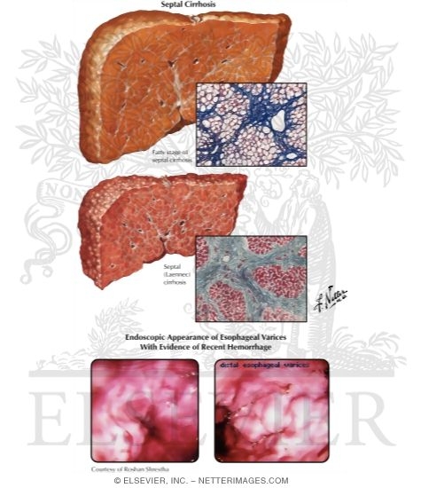 Watermarked preview of labeled image: Nutritional Liver Diseases