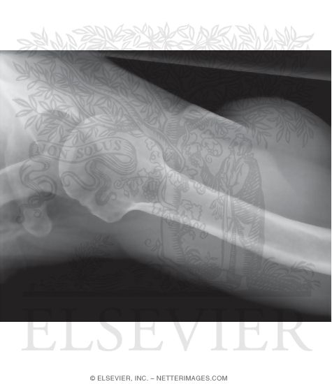 Shoulder: Axial View