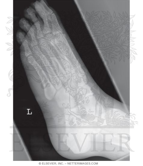 Foot: Oblique View
