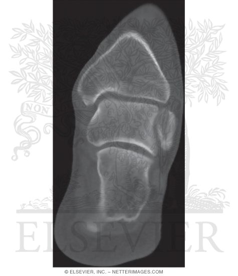Watermarked preview of unlabeled image: CT of Ankle and Foot