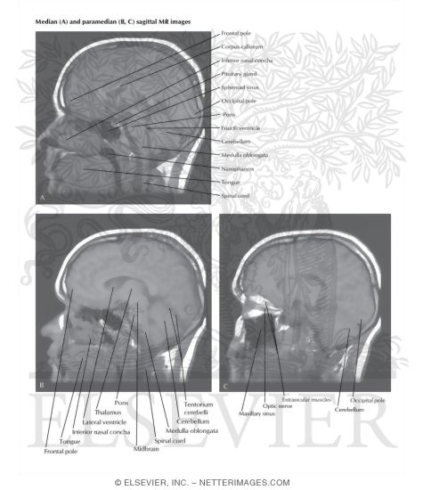 Watermarked preview of labeled image: Head Scans: Sagittal MR Images