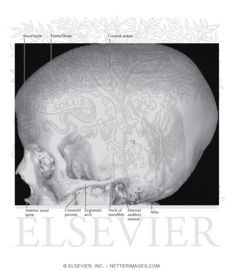 3D CT Scan of Left Lateral Skull