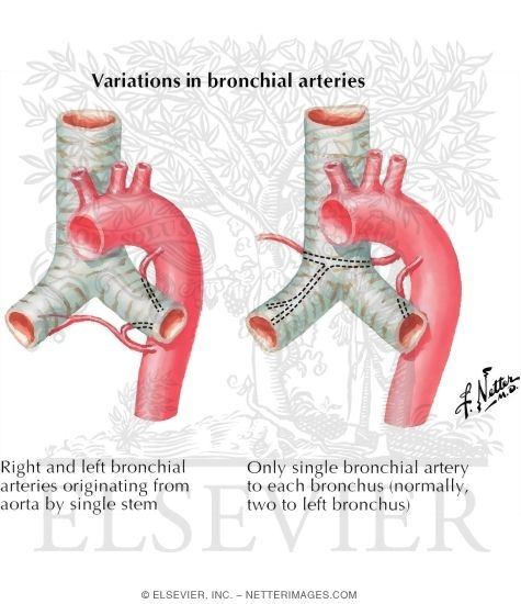 Variations In Bronchial Arteries