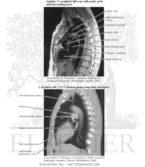 Imaging of Lung (Sagittal T1 and CE CT)