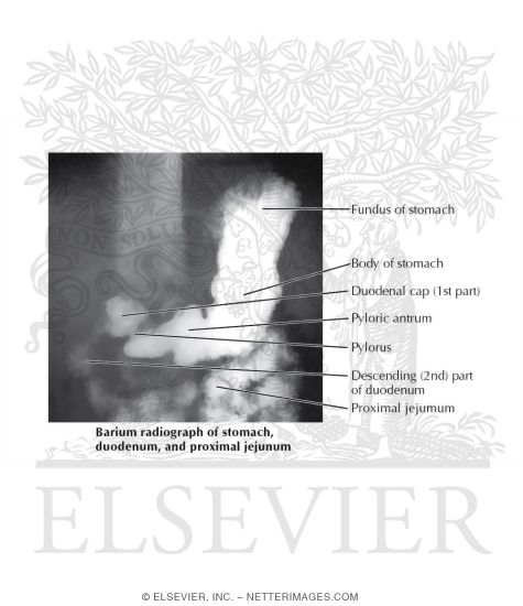 Barium Radiograph of the Stomach, Duodenum, and Proximal Jejunum