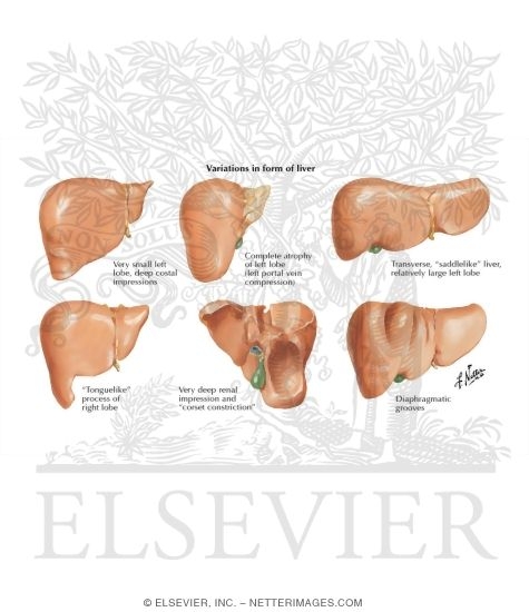 Watermarked preview of labeled image: Variations In Form of Liver