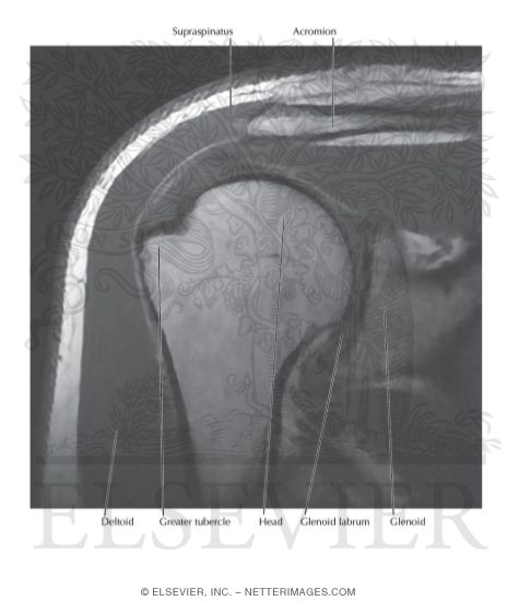 Shoulder MRI