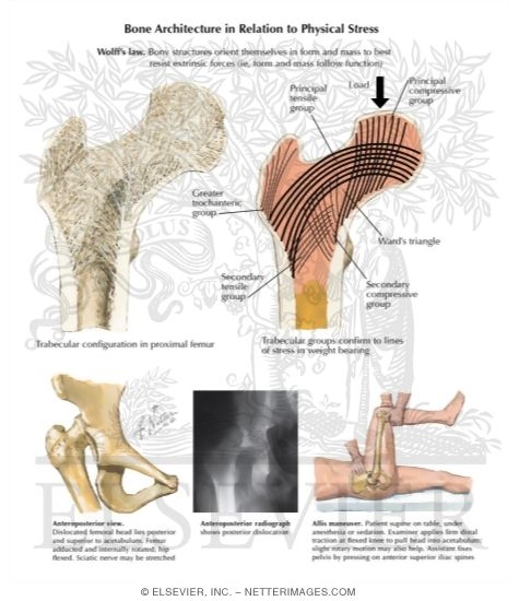 Watermarked preview of unlabeled image: Hip Dislocation