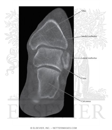 CT of Ankle and Foot