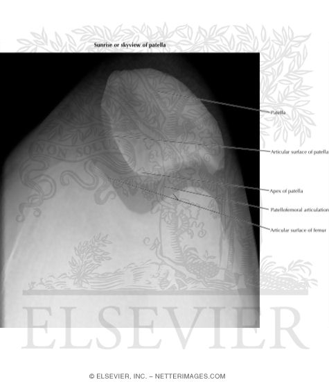 Sunrise Or Skyview of Patella