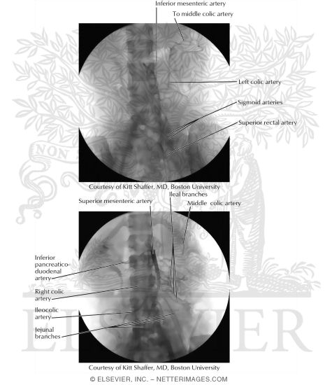 Arteriograms: Superior and Inferior Mesenteric Arteries