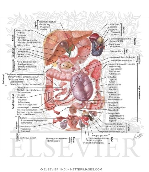 Watermarked preview of labeled image: The Acute Abdomen