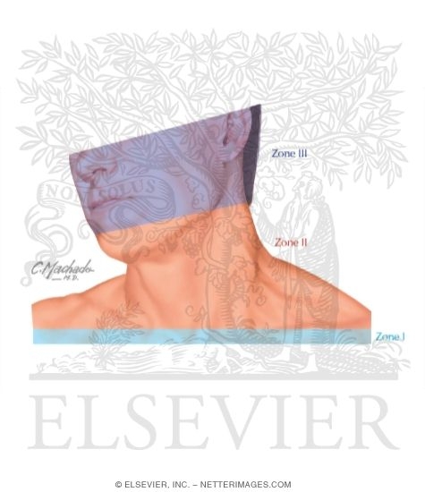 Zones of the Neck