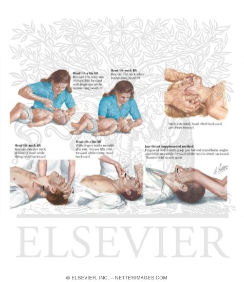 Head Tilt-Chin Lift and Jaw Thrust Maneuvers