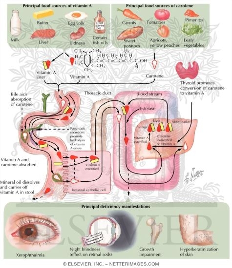 Watermarked preview of labeled image: Vitamin A Deficiency
