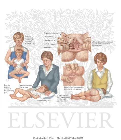Child Abuse: Genital Examination