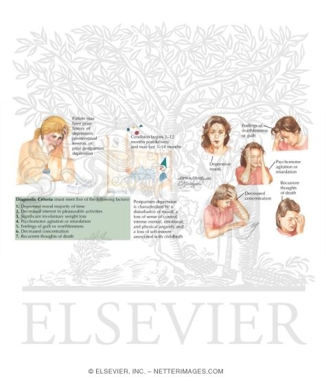 Watermarked preview of labeled image: Postpartum Depression
Depression: Postpartum