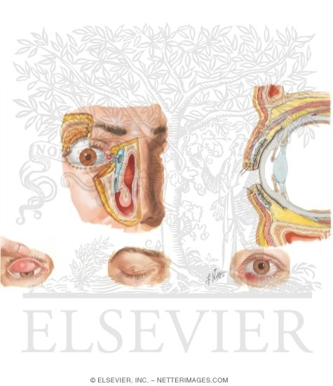 Watermarked preview of unlabeled image: Disorders of the Adnexal Structures