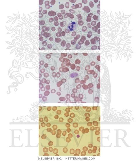 Peripheral Blood Smears