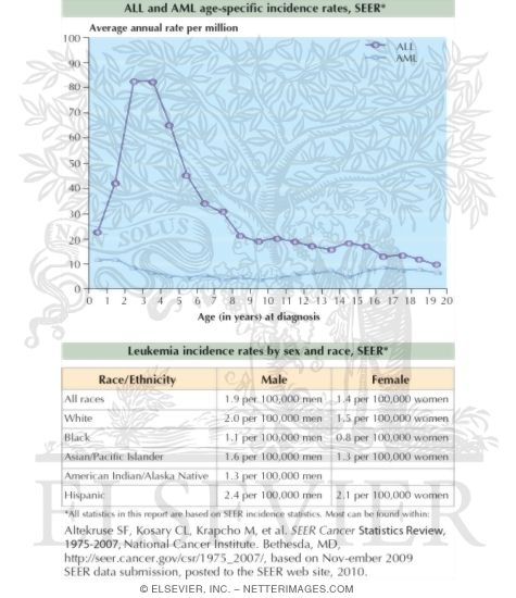 Incidence Rates of Acute Lymphoblastic Leukemia and Acute Myelogenous ...