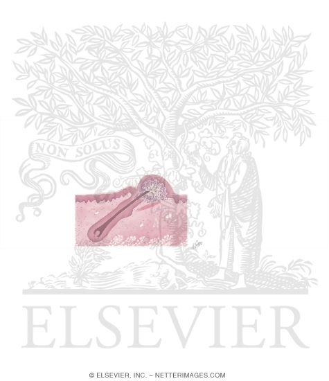 Watermarked preview of unlabeled image: Shaving: A Cause of Skin Disorders