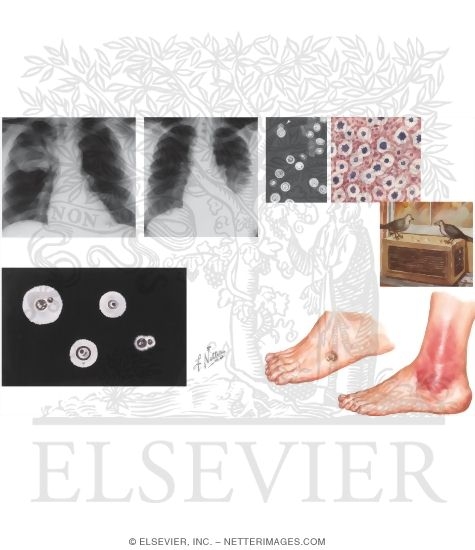 Watermarked preview of unlabeled image: Cryptococcus