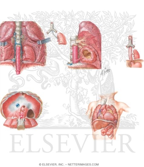 Anatomic Abnormalities