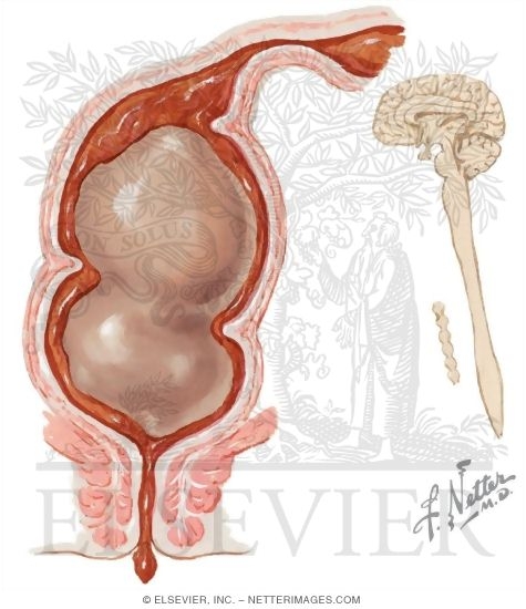 Watermarked preview of unlabeled image: Pathophysiology of Defecation