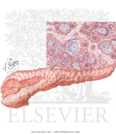Pancreatic Disease In Cystic Fibrosis