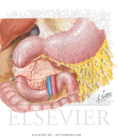 Annular Pancreas