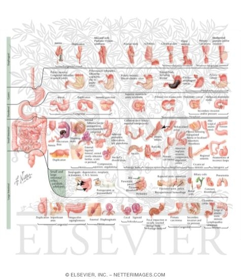 Alimentary Tract Obstruction