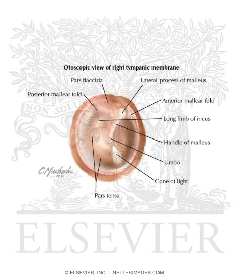 Right Tympanic Membrane