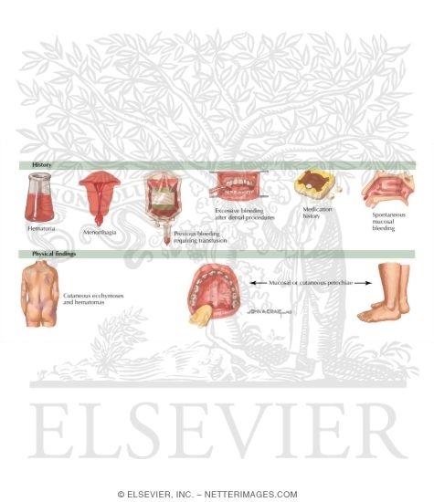 Clinical Presentation of Patients With Bleeding Disorders