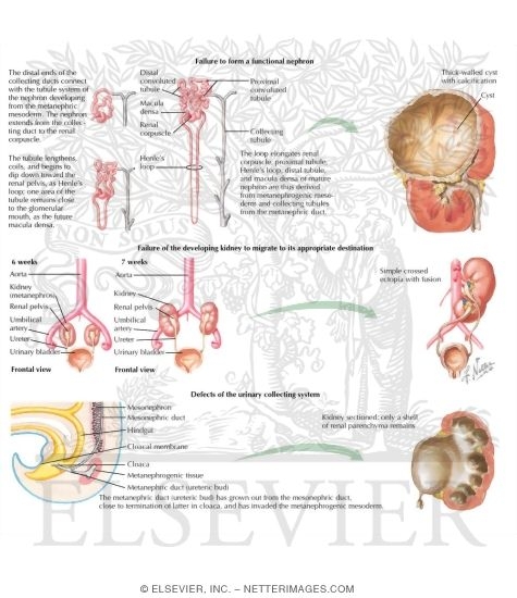 Watermarked preview of labeled image: Congenital Anomalies Categories