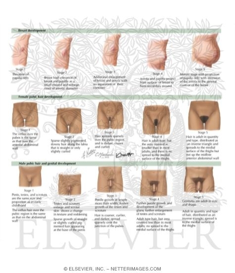 Watermarked preview of labeled image: Tanner Staging System