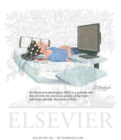 Watermarked preview of labeled image: Epilepsy Testing